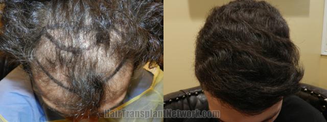  before and after result photographs