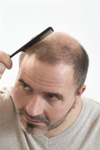 Hair Loss Lotions, Potions and "Cures"