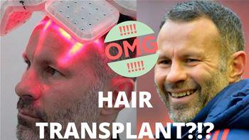 Ryan Giggs Shares His Hair Loss and Hair Transplant Journey