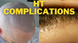 Hair Transplant Complications What Are They and How To Avoid Them