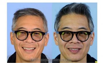 Before and after