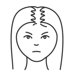 female hair loss